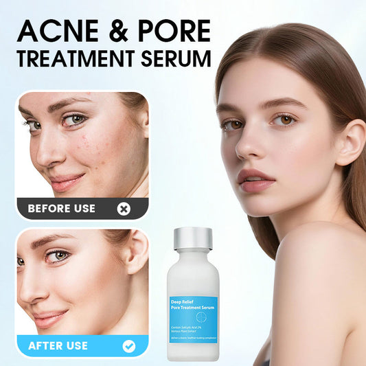 Clear Acne & Shrink Pores Fast! 💧 Acne Control Serum – Oil-Free, Visible Results in Weeks