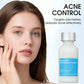 Clear Acne & Shrink Pores Fast! 💧 Acne Control Serum – Oil-Free, Visible Results in Weeks